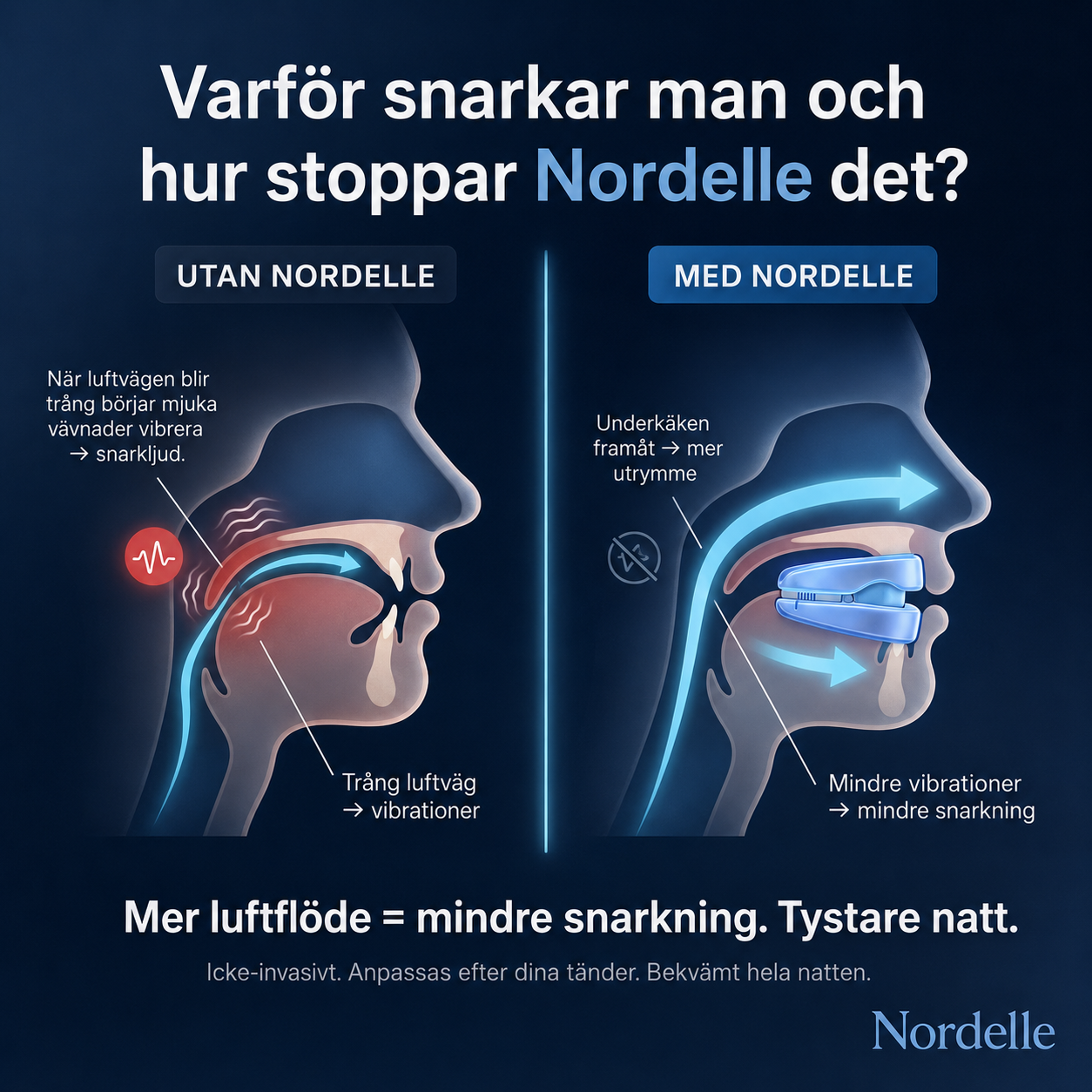 Nordelle™ – Minskar Snarkning Naturligt