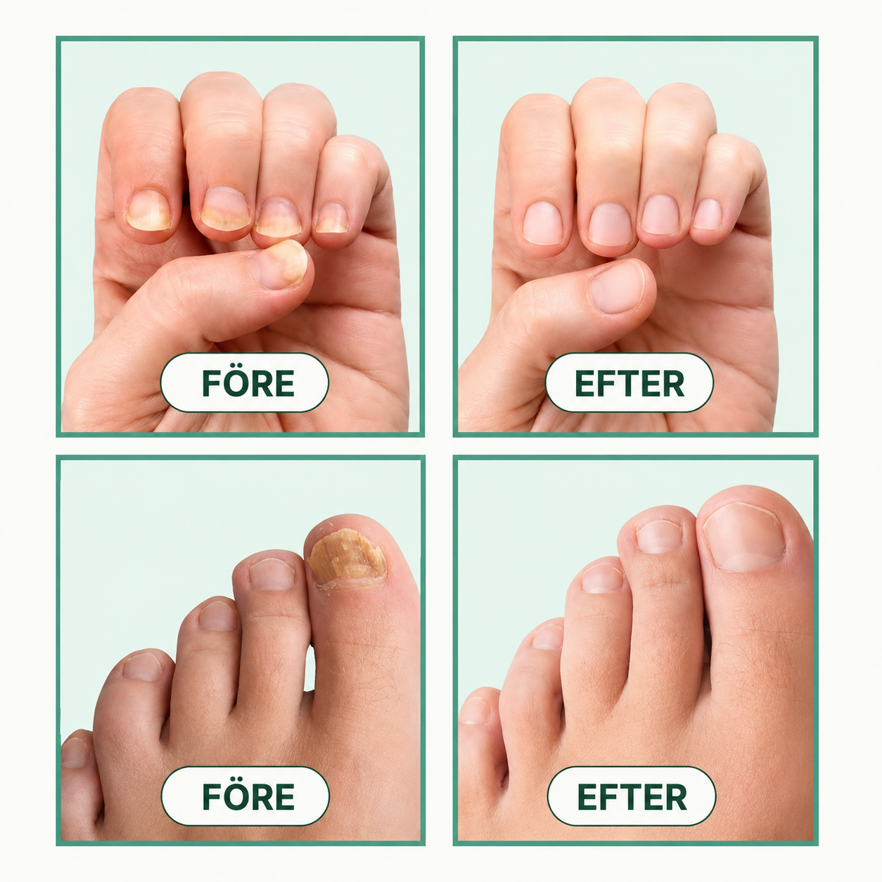 Rootcare Enheten
